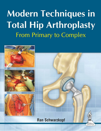 Modern Techniques in Total Hip Arthroplasty From Primary to Complex