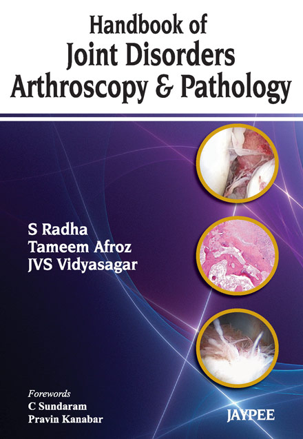 Handbook of Joint Disorders: Arthroscopy and Pathology