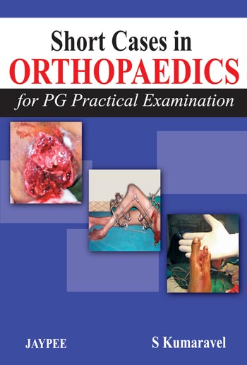 Short Cases in Orthopaedics (For PG Practical Examination)