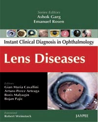 Instant Clinical Diagnosis in Ophthalmology: Lens Diseases