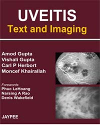 Uveitis: Text and Imaging