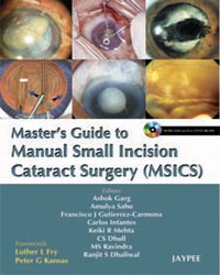 Master's Guide to Manual Small Incision Cataract Surgery (MSICS)