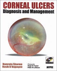 Corneal Ulcers Diagnosis and Management with DVD-ROM