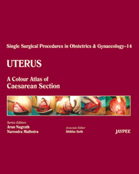 Single Surgical Procedures in Obstetrics and Gynaecology–14: A Colour Atlas of Caesarean Section