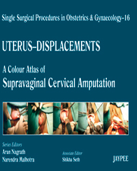 Single Surgical Procedures in Obstetrics and Gynaecology-16: A Colour Atlas of Supravaginal Cervical Amputation (Nadkarni's)