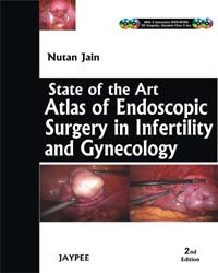 State of the Art: Atlas and Endoscopy Surgery in Infertility and Gynecology (with 4 DVD-ROMs)